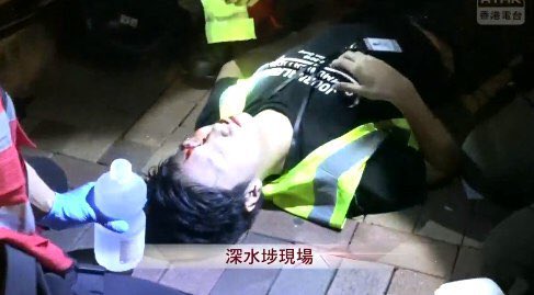 Journo got headshot in SSP(Sham Shui Po) just now #antielab #85HKonStrike