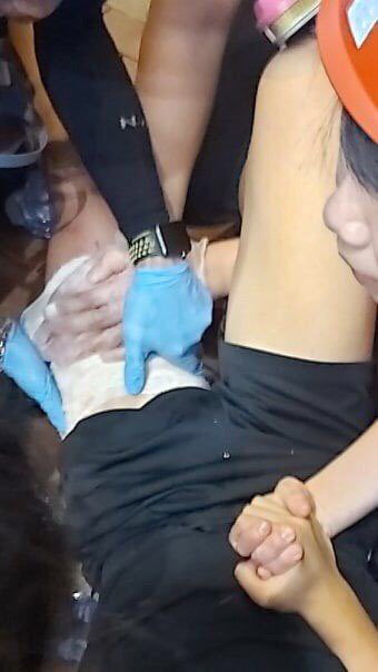 A student got shot by live round at Yuen Long 